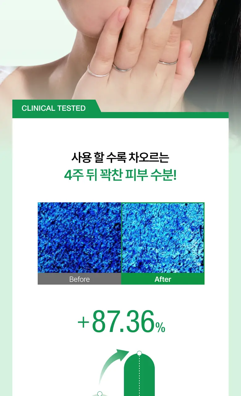[올영단독] 아누아 패드 리필 기획 3종(어성초/피디알엔/카테킨) 상세페이지 16